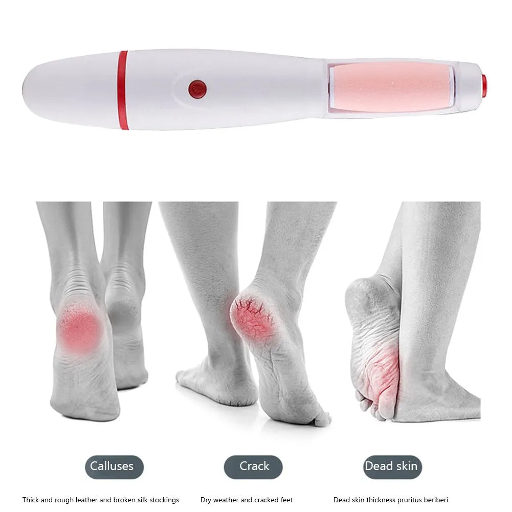 Rechargeable Pedicure Callus Remover for Smooth Feet